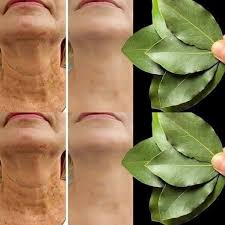 El laurel es 100.000 veces más potente que el bótox. Borra todas las  arrugas, incluso a los 70 años. Tengo que decir algo para poder seguir  recibiendo mis recetas… Gracias. Receta en (comentario).