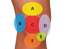 Lateral Knee Pain Diagnosis Treatment Knee Pain Explained