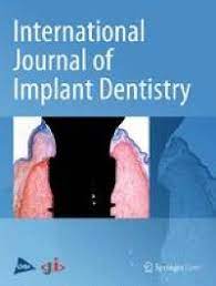General Review Of Titanium Toxicity International Journal Of Implant Dentistry Full Text