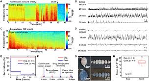 Bbc news provides trusted world and uk news as well as local and regional perspectives. Soft Implantable Drug Delivery Device Integrated Wirelessly With Wearable Devices To Treat Fatal Seizures Science Advances