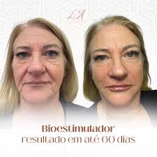 Dra. Larissa Azeredo Biomédica Esteta‎