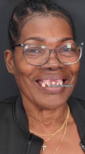 Wow the before and after is crazy! She looks like a whole new person!!  😳😳😳 CC*