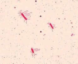 Bacillus Cereus Extension Medical Laboratory Science Microbiology Lab Microbiology