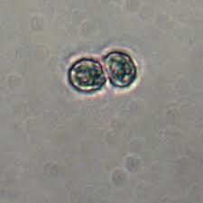 Image result for Russula flavida