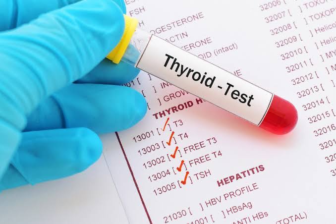TSH Test (THYROID STIMULATING HORMONE) product image