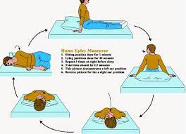 The epley maneuver, also known as the canalith repositioning maneuver or particle repositioning maneuver, is a series of exercises used to treat benign paroxysmal positional vertigo (bppv). Epley Maneuver Physiotherapy Exercise Technique Of Vertigo