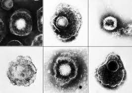 Herpes blood tests generally, it takes about two weeks for your body to produce detectable antibodies against herpes virus infection. Flawed Herpes Testing Leads To False Positives Needless Suffering Stat