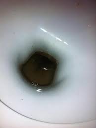 Wie Kann Ich Diese Braune Flecken In Der Toilette Entfernen Klo Schmutz