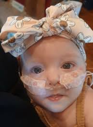 Breast milk donation for surrogacy support needed