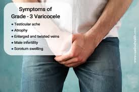 Image result for Varicocele