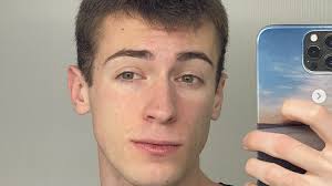 È guerra tra Lollolacustre e Dottor Bavaro: Sfrutti il mio nome