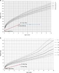 Patients Growth Chart A And Weight Chart B Bone Age