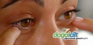 Goz Segirmesi Neyin Belirtisi Nasil Gecer Doktor Dan Tavsiyeler Dogal Cilt Bakimi Dogal Cilt Bakimi Dogal Cilt Cilt Bakimi