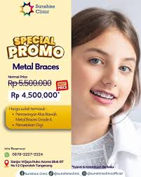 Halo Sahabat Sunshine✨ Jangan lewatkan promo Metal Braces Grade A dibulan  ini yaa😉 Promo pemasangan behel ini sudah termasuk cetak gigi dan  pemasangan behel atas dan bawah😍 Yuk manfaatkan promonya dan reservasi