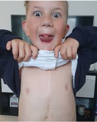 Children's Heart Surgery Fund