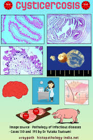 Pathology Of Cysticercosis Pathology Infectious Disease R Co