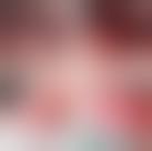 Image result for Perinephric Abscess