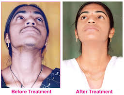 Ayurvedic Clinics in Gokak, Belgaum