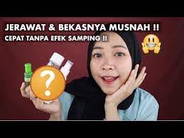 Cara menghilangkan jerawat secara alami. Cara Menghilangkan Jerawat Bekasnya Dengan Cepat Tanpa Efek Samping Youtube