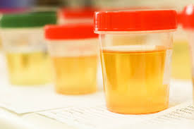 If you have the time and you wait long enough, this will work 100% of the time. Drug Testing Deception Trends And Why They Don T Work Employment Screening Services