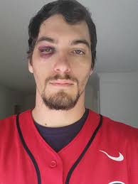 Update! Day 2 of #AustinRiley Homerun to the face. Phillies fan took the  ball. Austin Riley, let me get a signed ball! : r/Braves