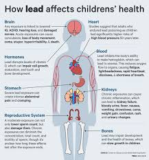 Image result for Lead Poisoning