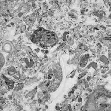 Thin Section Of The Brachiopod Bearing Limestone Download Scientific Diagram