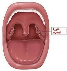 أعراض التهاب اللوزتين عند الاطفال. Ø§Ù„ØªÙ‡Ø§Ø¨ Ø§Ù„Ù„ÙˆØ²ØªÙŠÙ† Ø¹Ù†Ø¯ Ø§Ù„Ø§Ø·ÙØ§Ù„ Ù…Ù‚Ø§Ù„Ø§Øª Ù…Ù†ØµØ© Ø§Ù„Ù‚Ø§Ø±Ø¦ Ø§Ù„Ø¹Ø±Ø¨Ù‰
