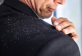 Patches of itchy or scaly. How To Get Rid Of Dandruff Causes Treatment Shampoo Symptoms