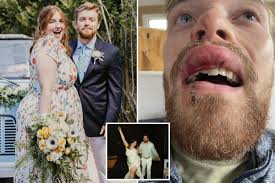 Bride marries toothless groom in wedding gone horribly wrong