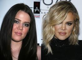 Today's cosmetic surgery is so advanced that it is hard to imagine any celebrity not being influenced by the miracles that surgery can bring. Celebrity Plastic Surgery 30 Before After Pics Stylecaster