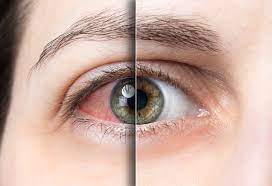 Find The Best Eye Drops To Use When High Leafbuyer