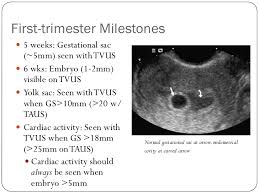 But many subchorionic bleeds are detected during a routine ultrasound , without there being any noticeable signs or symptoms. What Does Normal First Trimester Bleeding Look Like