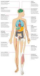 The human body is an ecosystem on steroids via its own internet network. The Effects Of Stroke On The Body