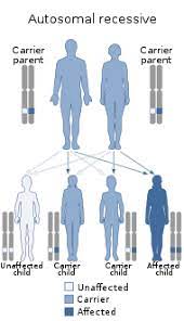 Waardenburg Syndrome Wikipedia
