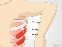 Back pain is a common complaint, and feeling aches and pain in the right side of the back under the ribs can have many causes. How To Check Lymph Nodes Lymph Nodes Lymph Nodes Armpit Swollen Lymph Nodes