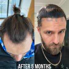 Doctor Bircan in Istanbul, Turkey • Read 28 Reviews