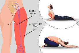 In yoga classes a student will often come to a teacher before class and state that she is suffering from sciatica. Best Yoga For Sciatica 10 Yoga Poses To Relief From Sciatica Pain Fitsri