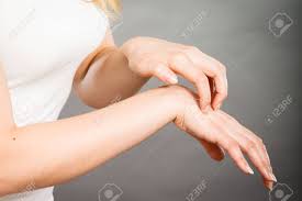 Dermatologia Alergias Y Problemas De Salud La Hembra Joven Rascarse La Picazon En La Palma De La Mano Con La Erupcion De La Alergia Fotos Retratos Imagenes Y Fotografia De Archivo Libres