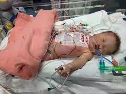Northampton mum calls for volunteers to relieve families who, like her, have  a baby with heart disease