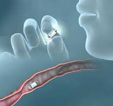 Image result for Virtual Endoscopy