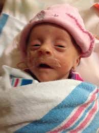 Prayers for Ava and Emma