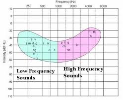 The Best Hearing Loss Simulations Understanding Audiograms