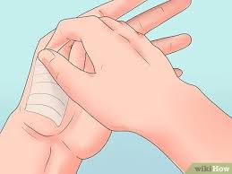 This allows for faster healing from the inside out. Steri Strips Entfernen 9 Schritte Mit Bildern Wikihow