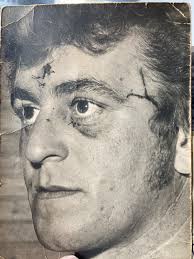 Ringo with his parents outside 10 Admirals Grove early 60s (socks with  sandals 😲😲). If you look carefully you can still see the distinctive scar 