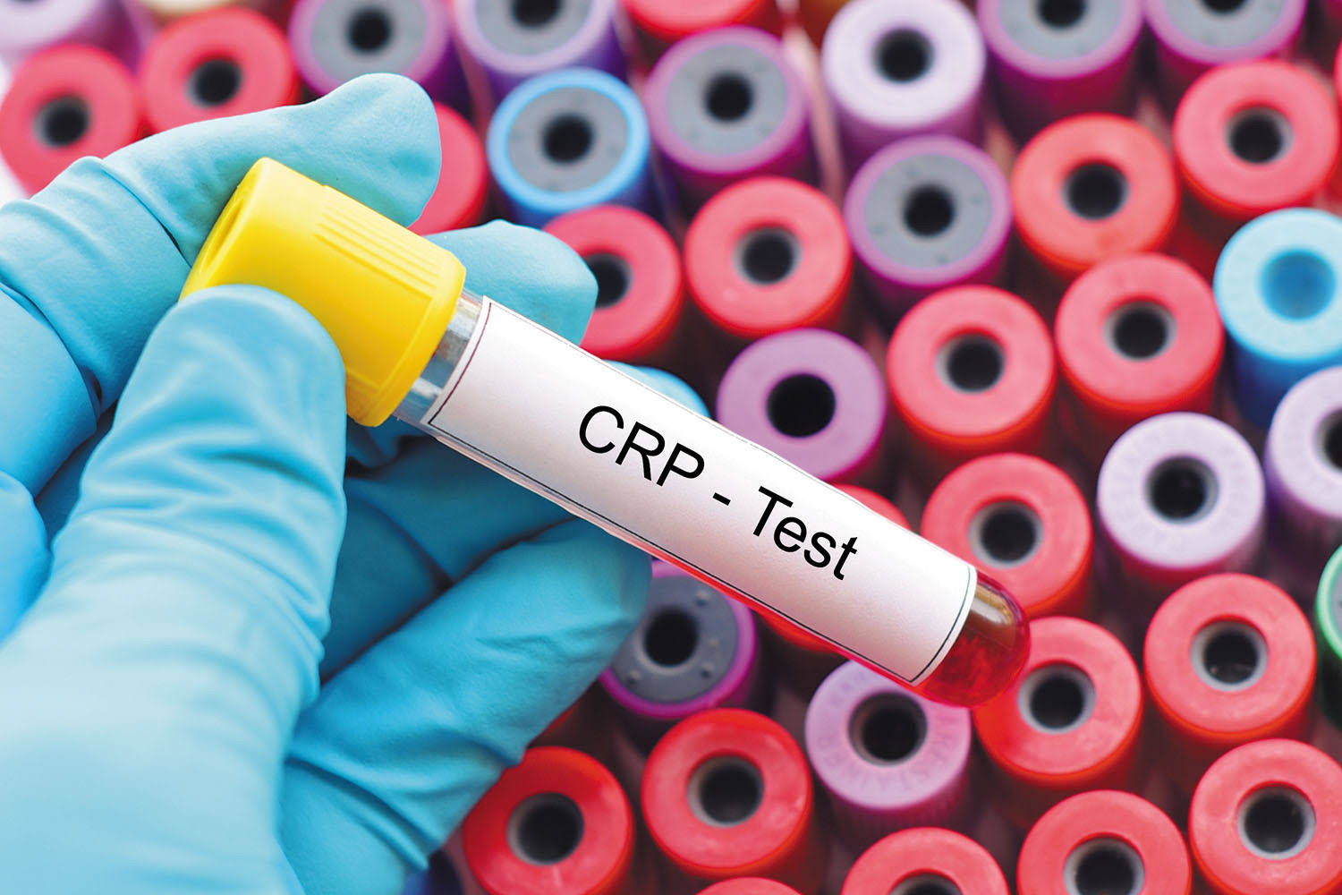 CRP product image