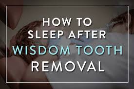 Jan 22, 2019 · stay away from alcohol in the recovery period after dental surgery. How To Sleep After Wisdom Tooth Removal The Best 5 Tips T