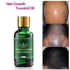 At Yagi Sac Dokulmesi Urunleri Yumusak Onarim Gelistirmek Puruzsuz Besleyici Nemlendirici Yag Kontrolu Essential Oil Hair Growth Hair Growth Serum Hair Growth