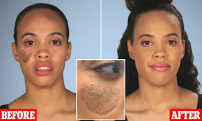 As to why it actually is like that, there might be a couple of factors, one is believed to be the fact that curly hair helps contain the pheromones produced. Woman 30 Reveals She Was Left With Pubic Hair Growing On Her Face After Skin Graft Daily Mail Online