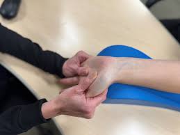 Image result for Hand Injury